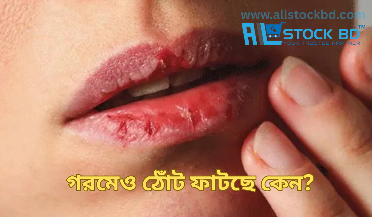 গরমেও ঠোঁট ফাটছে কেন?